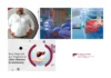 Top Liver Cirrhosis Specialist in Ahmedabad for Advanced Liver Disease Care