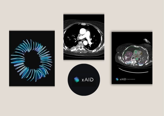 How AI Radiology Reporting Helps Local Clinics Improve Outcomes