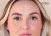 Wimperlift vs Lash Lift: Choose the Right Treatment